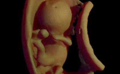 VR+磁共振让准爸妈“瞅瞅”未出生的宝宝